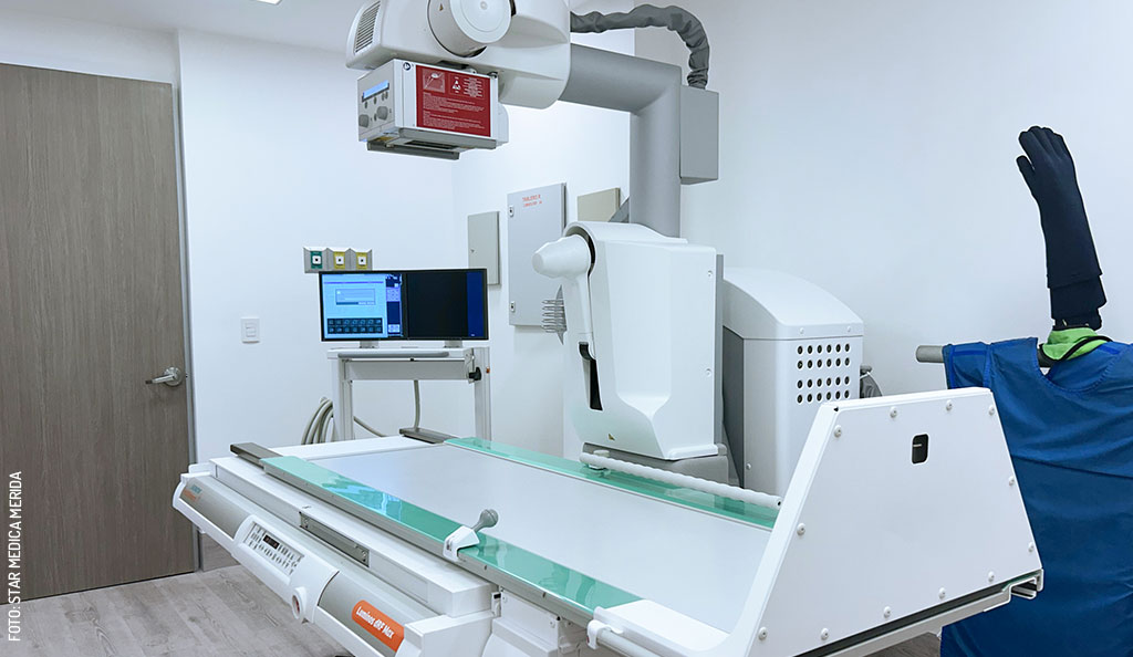 Star-Medica-Merida-Siemens-Luminos-dRF-Max-4-by-Star-Medica